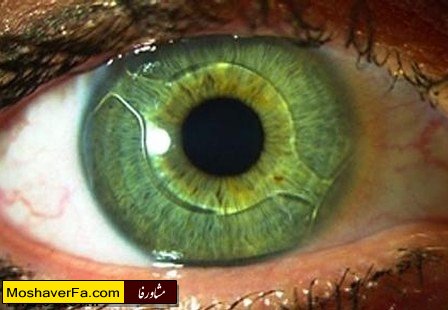 c3aade07b6f3a13966b1c56f182013cc.jpg